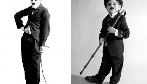 Andar com os pés para fora é problema-Dr-David-Nordon-Ortopedista-Infantil