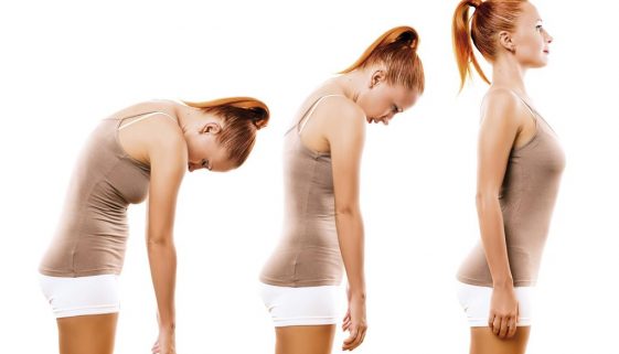 Dorso curvo é só postural-Dr-David-Nordon-Ortopedista-Infantil